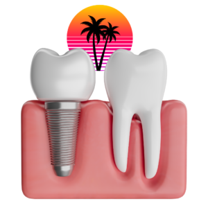 Dental Implants Miami Style