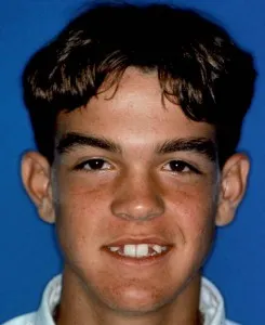 Before implant surgery, two missing front teeth